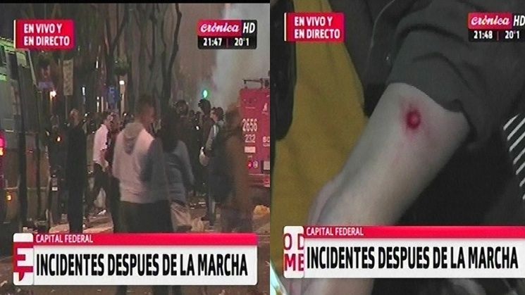 Heridos de bala, apaleados, detenidos y una verdadera cacería policial después del acto en la Plaza por Santiago